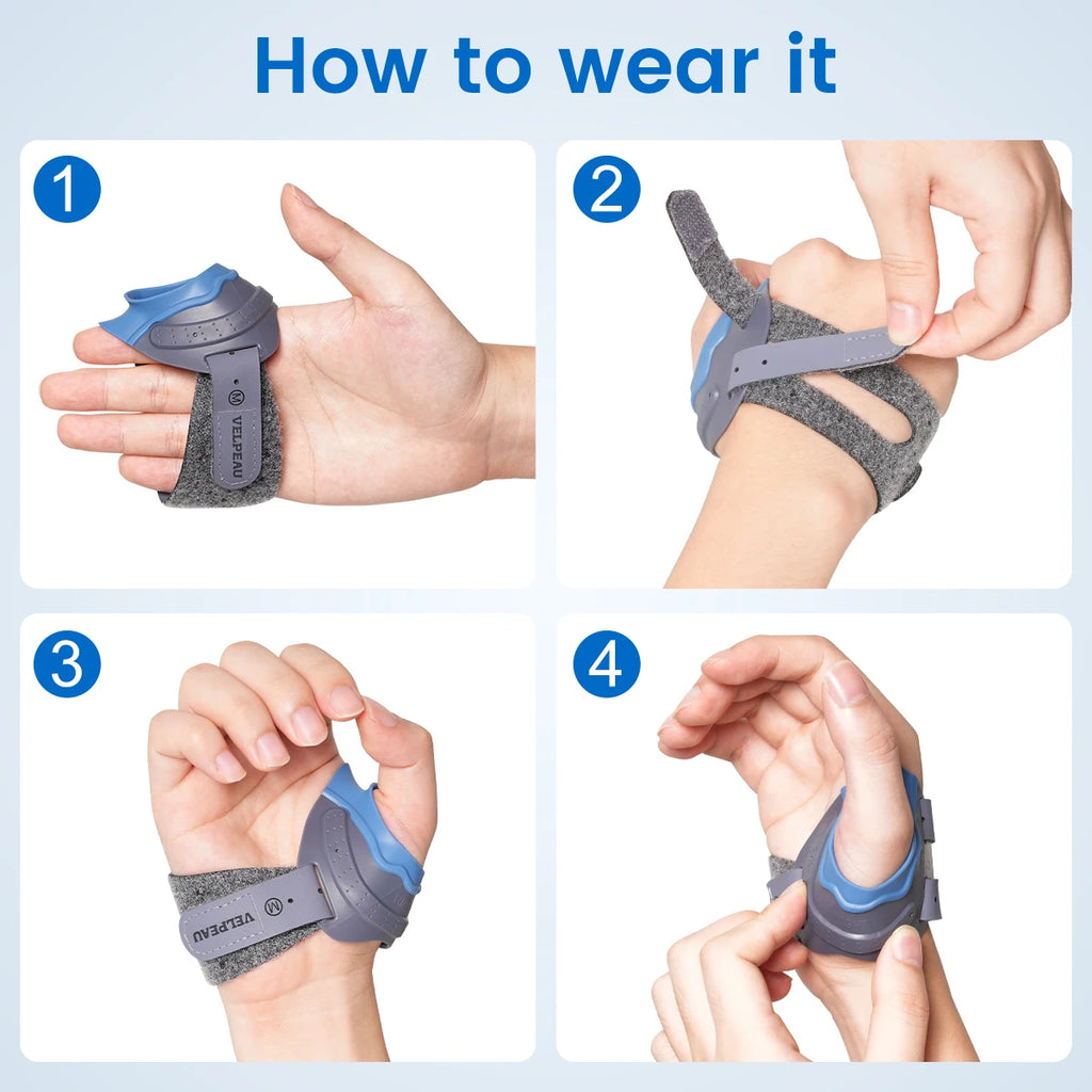 VELPEAU CMC Thumb Brace with Shape-memory Restriction Splint, Thumb CMC Joint Stabilizer for Thumb Basal Arthritis Pain