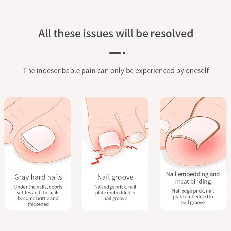 Professional Toe Nail Clippers Cutter Ingrown Toenail Tool Thick Nail Dead Skin Dirt Remover Super Sharp Curved Blade Nail Tools