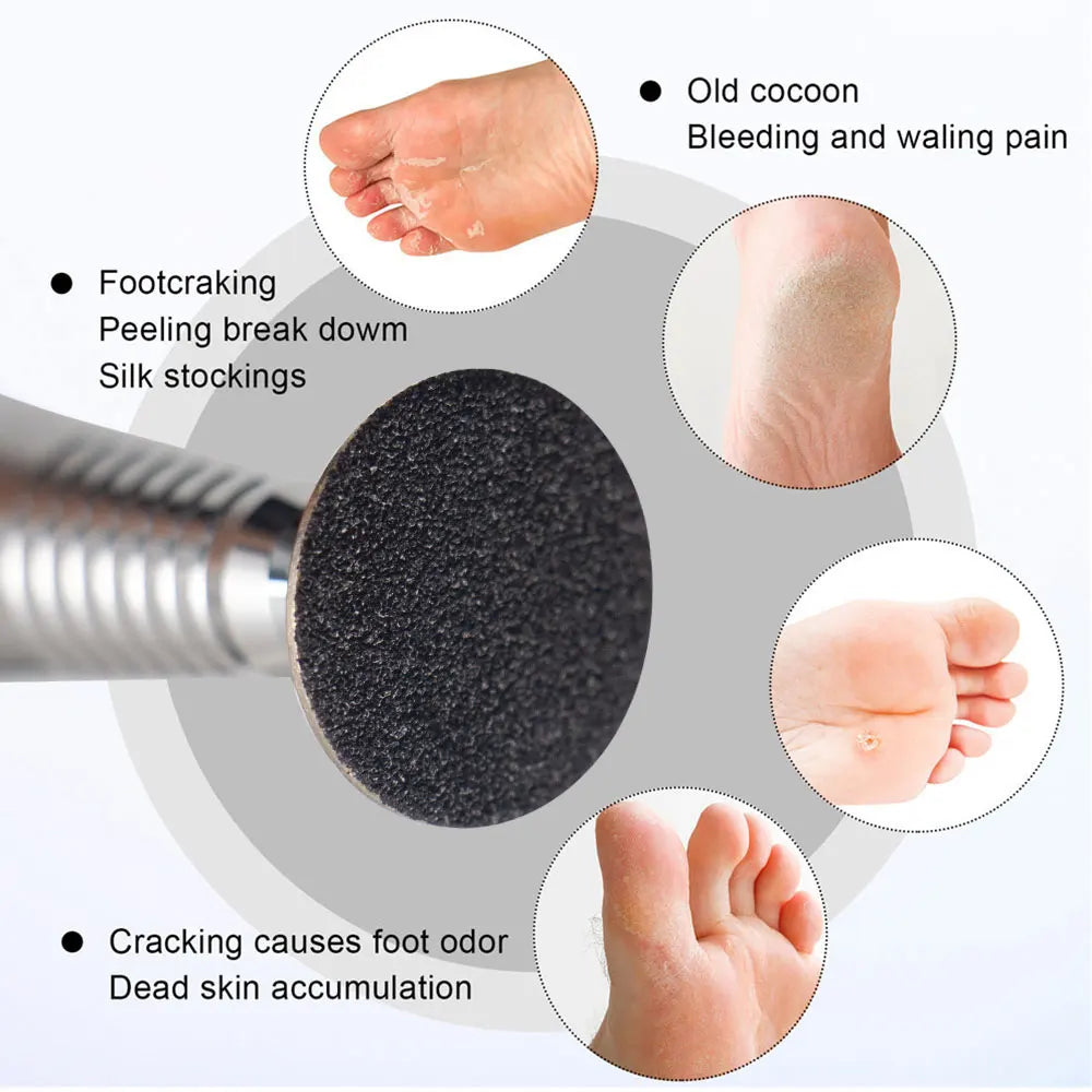 100Pcs Sandpaper With Metal Nozzle For Foot Files Dead Skin Callus Remove Tool Cuticle Pedicure Tool Sanding Paper Set