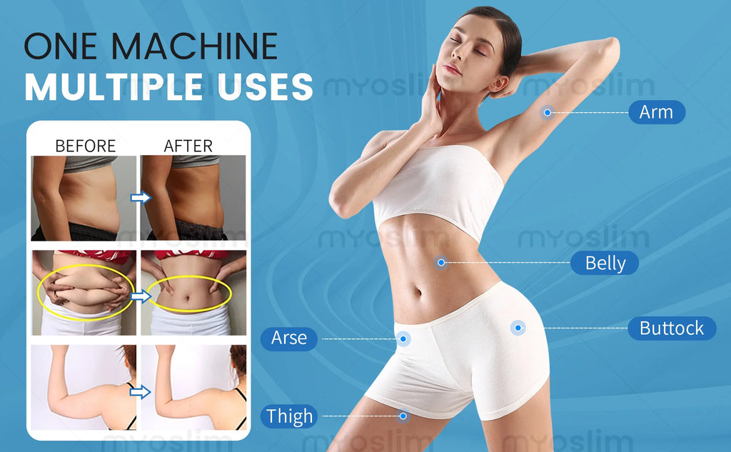 MyoSlim 6500W RF EMS Body Sculpting Machine  Technology  Professional Fat Burning & Muscle Toning Equipment