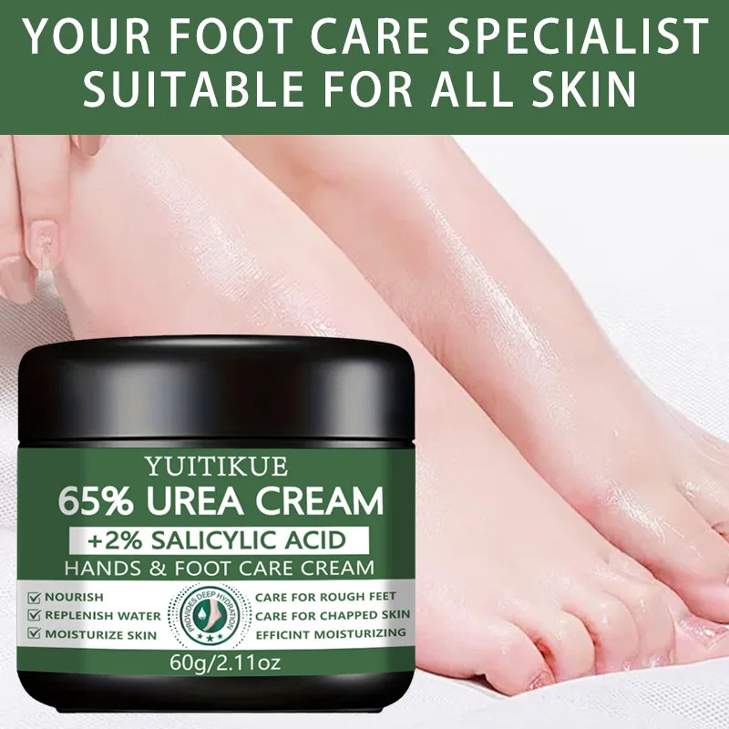 YUITIKUE 65% Urea Hand & Foot Cream 60g - with 2% Salicylic Acid, Repairs Dry Cracked & Rough Skin, Nourishes & Moisturizes