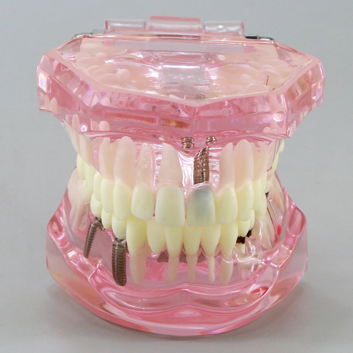 Dental Models Pink Disease Tooth Model Typodont Implant With Removable Tooth Restoration Bridge Teaching Tooth Model  M2001P