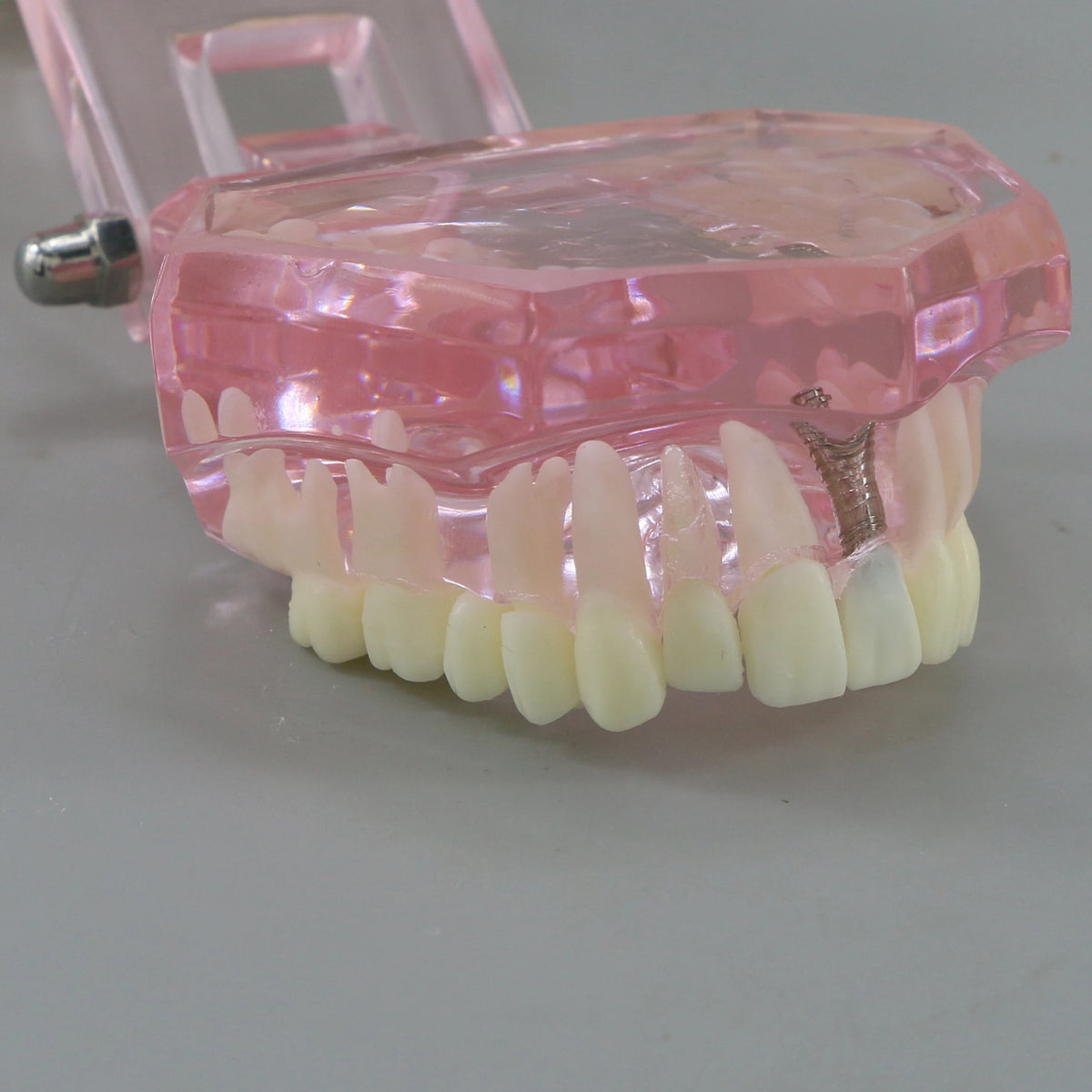 Dental Models Pink Disease Tooth Model Typodont Implant With Removable Tooth Restoration Bridge Teaching Tooth Model  M2001P