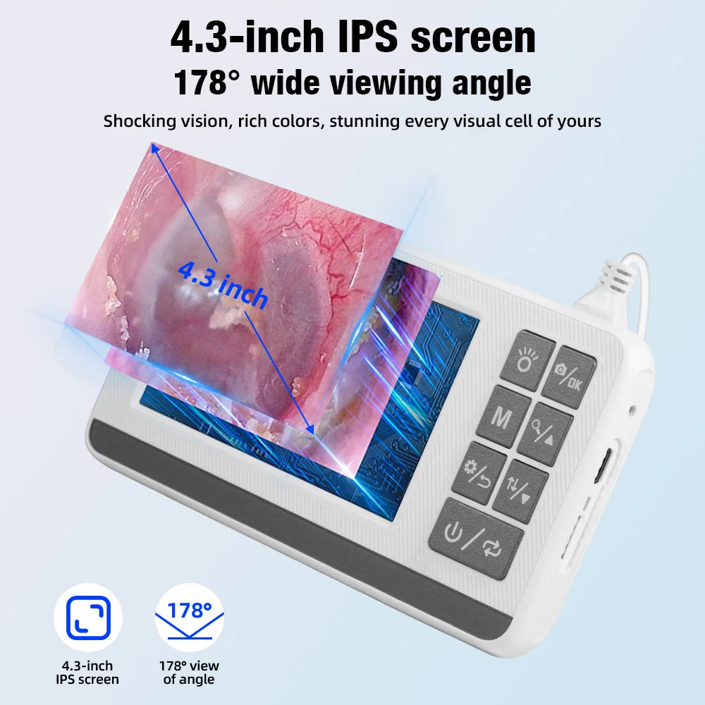 KERUI 3.9mm Visual Ear Wax Cleaner with 4.3 inch Screen Earwax Removal Otoscope Camera Tooth Ear Care Pick Cleaning Tools