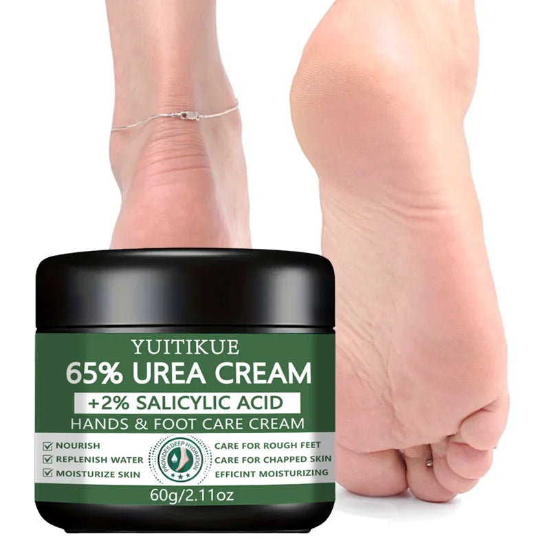 YUITIKUE 65% Urea Hand & Foot Cream 60g - with 2% Salicylic Acid, Repairs Dry Cracked & Rough Skin, Nourishes & Moisturizes