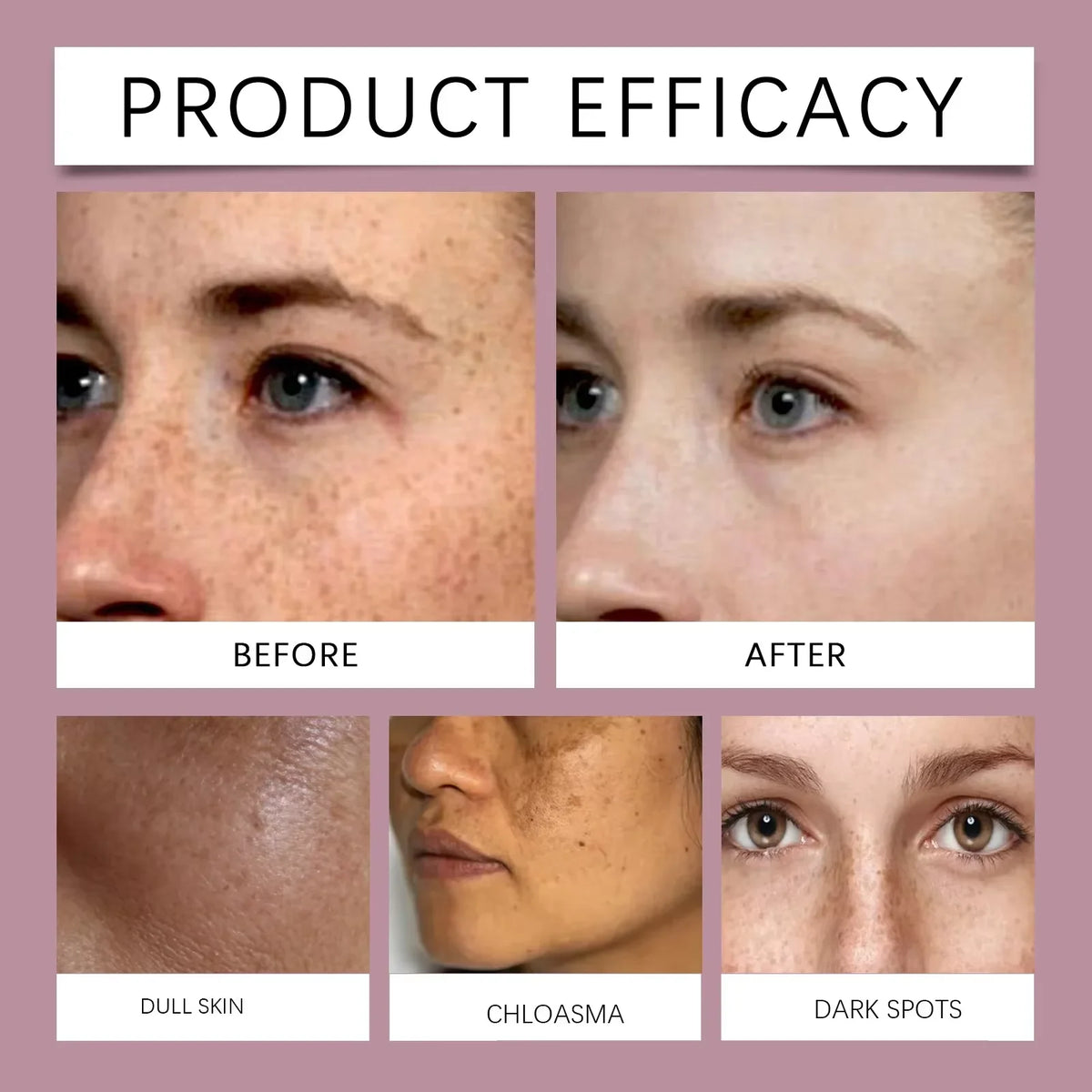 Vitamin C Whitening Freckles Serum Stick Remove Melasma Dark Spots Corrector Lighten Melanin Acne Anti-Aging Brighten Skin Care