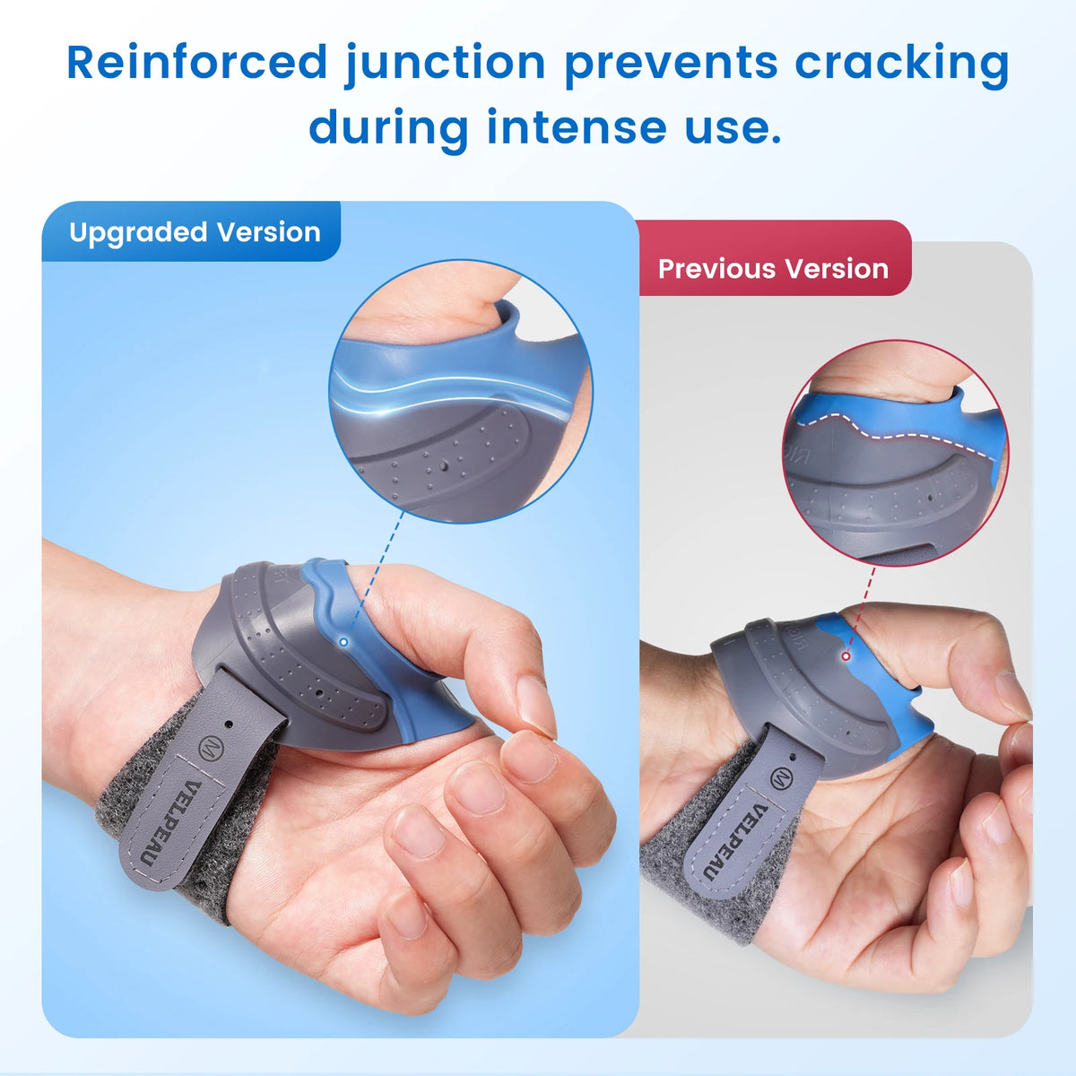 VELPEAU CMC Thumb Brace with Shape-memory Restriction Splint, Thumb CMC Joint Stabilizer for Thumb Basal Arthritis Pain