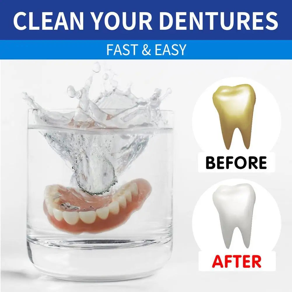100PCS/Set Denture Cleaning Tablets Removes Odor Oral Cleaning Retainer Cleaner Bad Odors Stains Plaque Remover Tooth Care