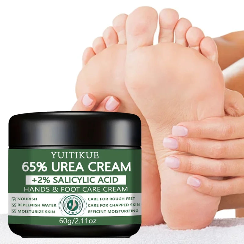 YUITIKUE 65% Urea Hand & Foot Cream 60g - with 2% Salicylic Acid, Repairs Dry Cracked & Rough Skin, Nourishes & Moisturizes