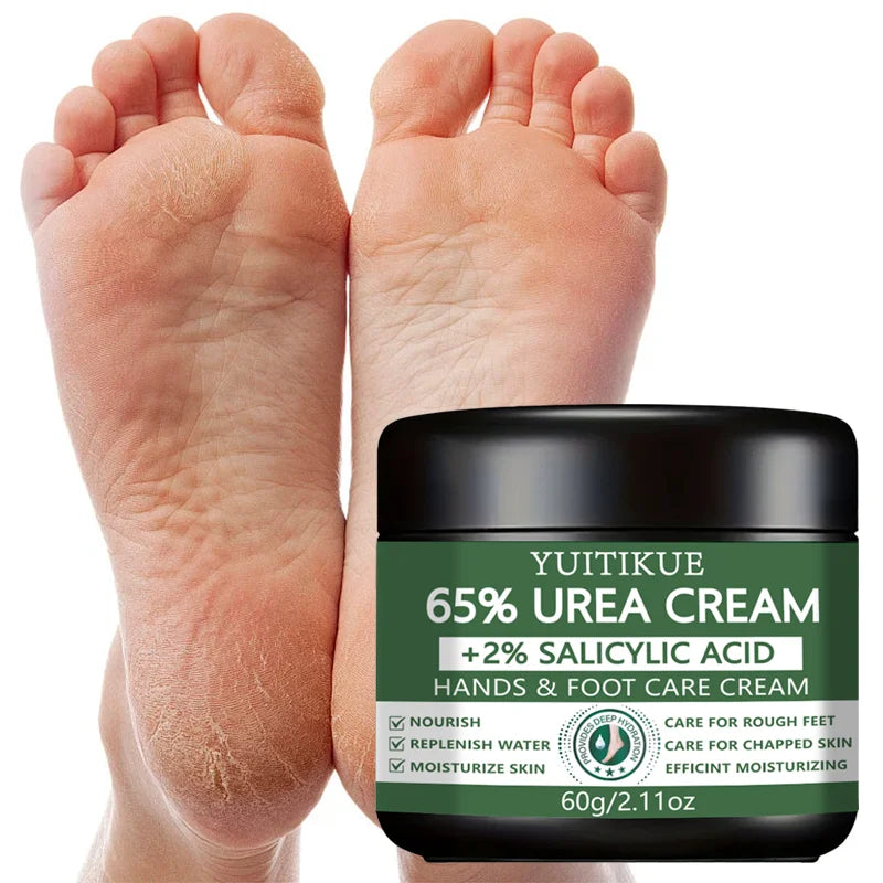 YUITIKUE 65% Urea Hand & Foot Cream 60g - with 2% Salicylic Acid, Repairs Dry Cracked & Rough Skin, Nourishes & Moisturizes