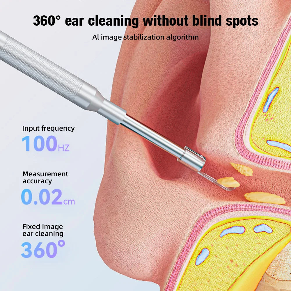 KERUI 3.9mm Visual Ear Wax Cleaner with 4.3 inch Screen Earwax Removal Otoscope Camera Tooth Ear Care Pick Cleaning Tools