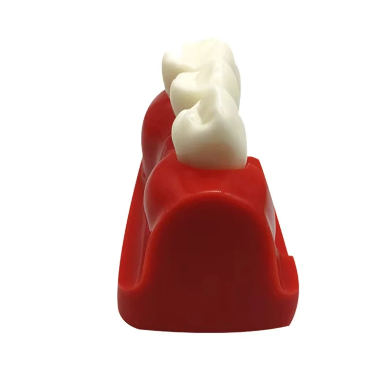 Dental 4 Times Implant Teeth model Analysis Crown Bridge Demonstration Removable Model Dentisty Study Training Teaching Model