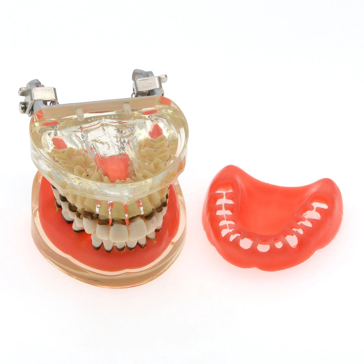Dental Teeth Model  Dentist Teaching Model Demonstration Periodontal Disease Pathological For Patient Education Demo M4017