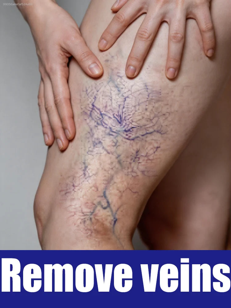Tender Care for Legs, Free from Unease, Ideal Pick