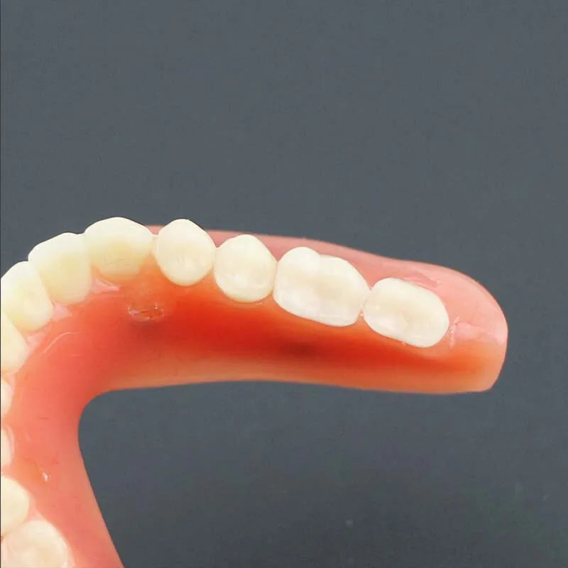Dental Teeth Model with Implant Overdenture Model Inferior Demo Teeth Model for Dentist Study Dental Teaching Model 2/4 Implants