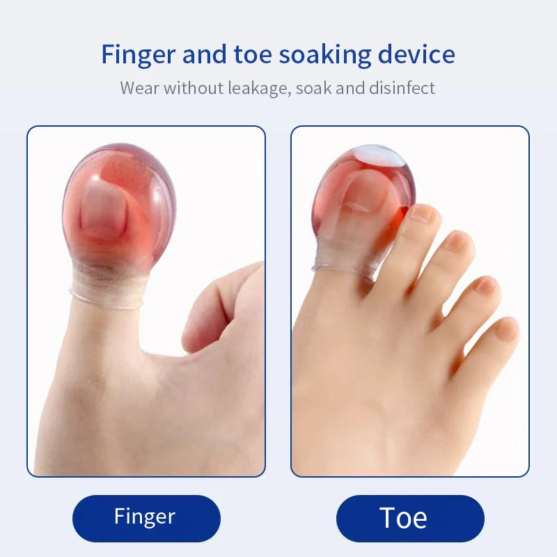 1Pcs Soft Silicone Toe Sleeves Toe Protectors, Reduce Friction Prevents Nail Insertion for Wound Care and Cutaneous Infections