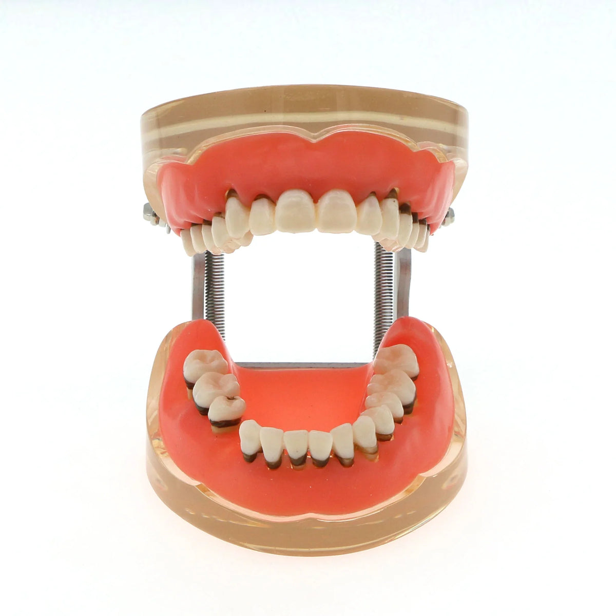 Dental Teeth Model  Dentist Teaching Model Demonstration Periodontal Disease Pathological For Patient Education Demo M4017