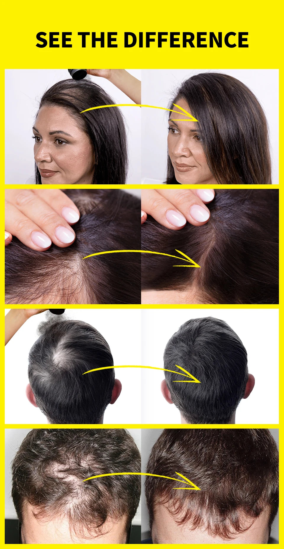 10Color Hair Fiber Powder 48 Hour Stain Proof Hair Building Fibers Instant Volume & Boost Hair Fiber Hairline Filling Powder