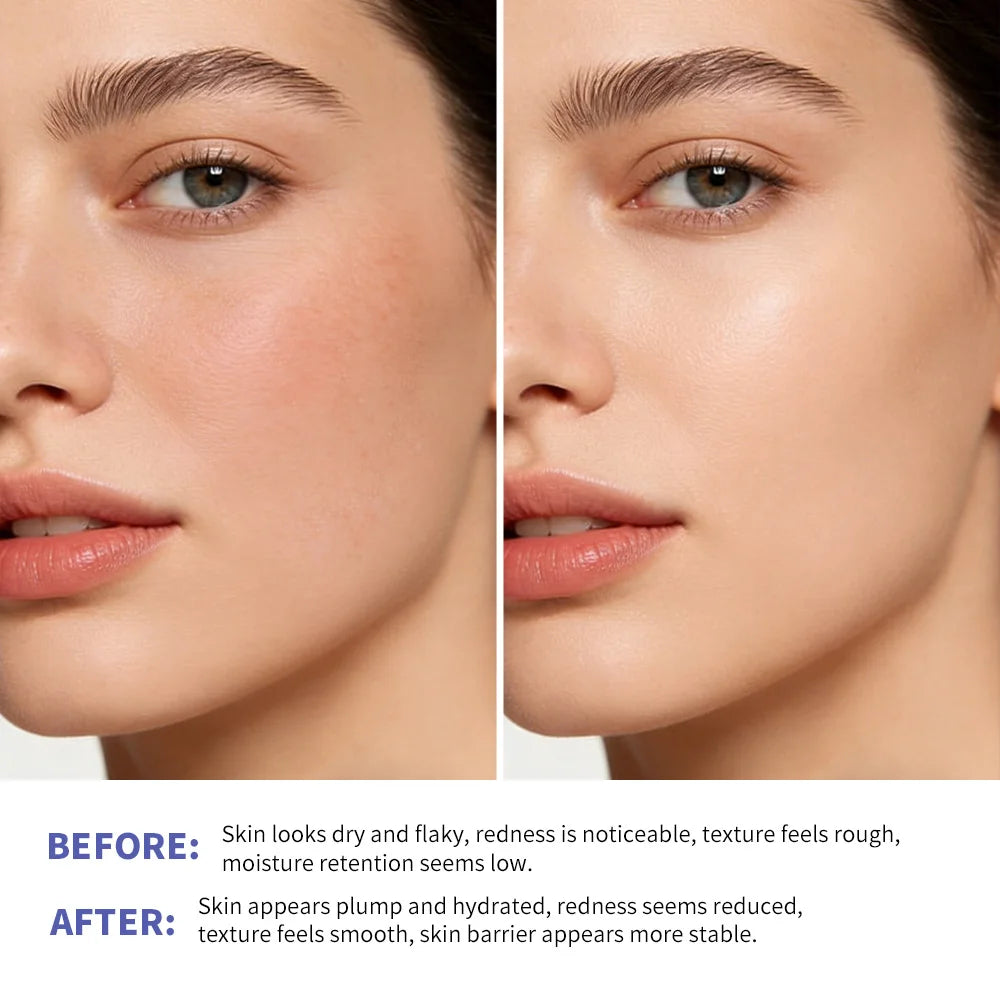 Triple Lipid Peptide Cream Long-lasting Moisturizing Deep Hydration Skin Care Face Cream for Dry Sensitive Skin Treatment