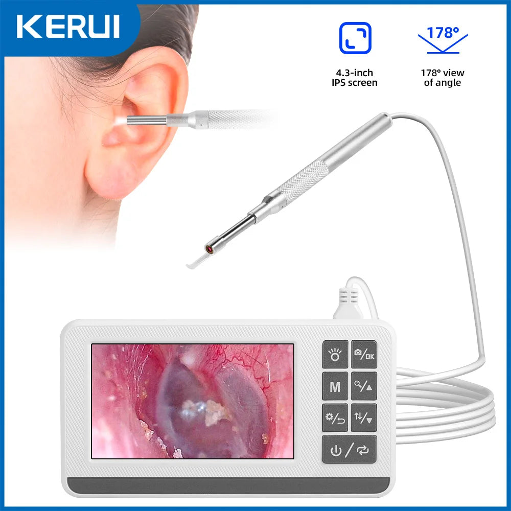 KERUI 3.9mm Visual Ear Wax Cleaner with 4.3 inch Screen Earwax Removal Otoscope Camera Tooth Ear Care Pick Cleaning Tools