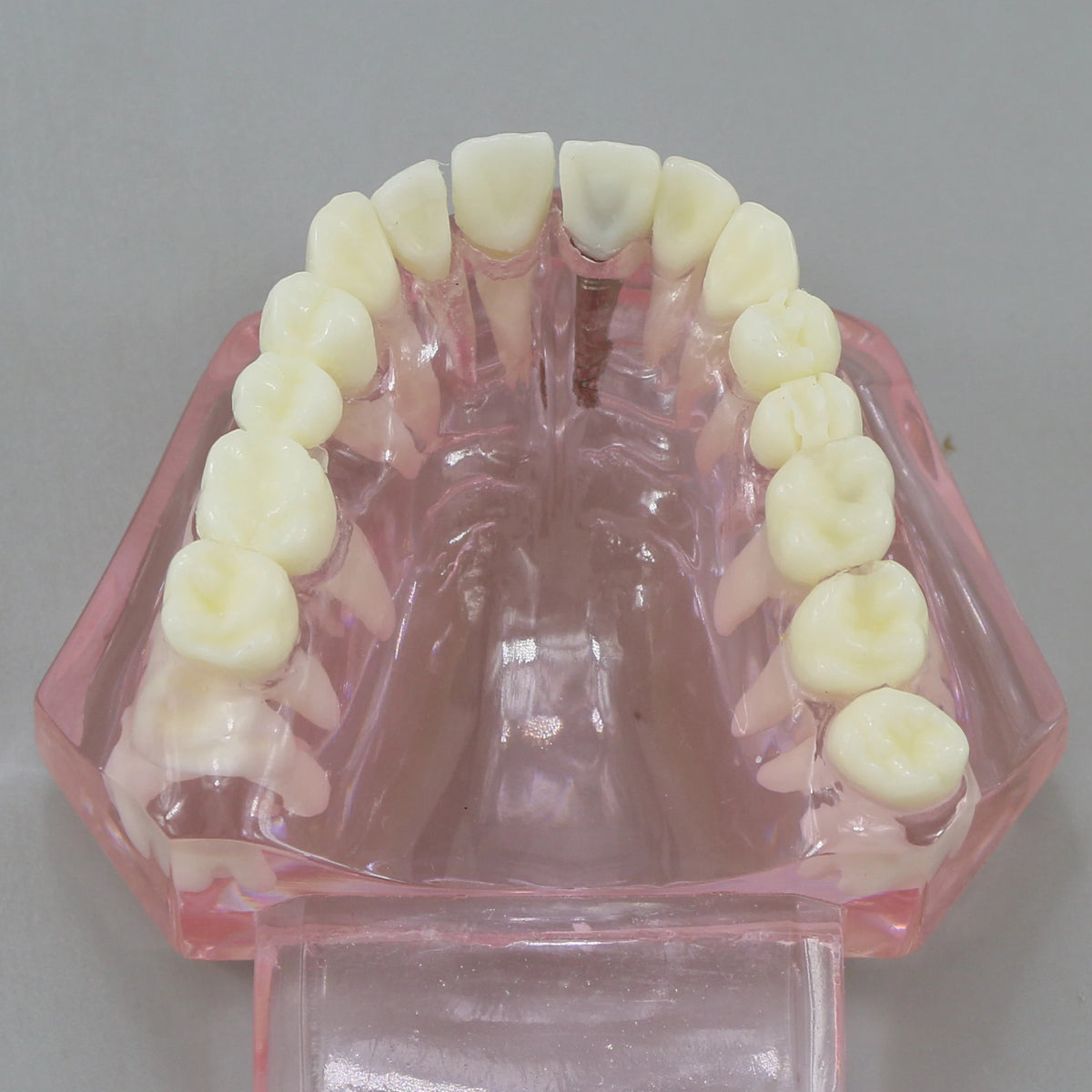 Dental Models Pink Disease Tooth Model Typodont Implant With Removable Tooth Restoration Bridge Teaching Tooth Model  M2001P