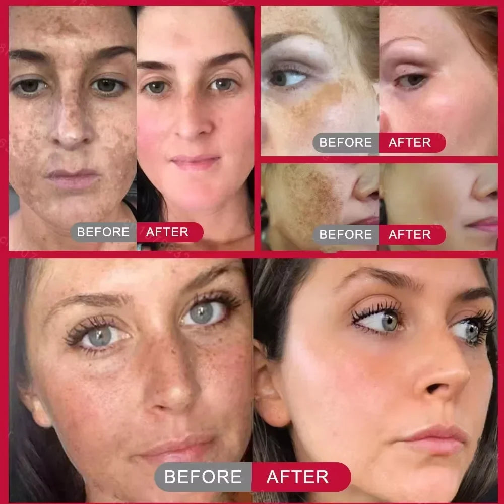Vitamin C Whitening Freckles Serum Stick Remove Melasma Dark Spots Corrector Lighten Melanin Acne Anti-Aging Brighten Skin Care