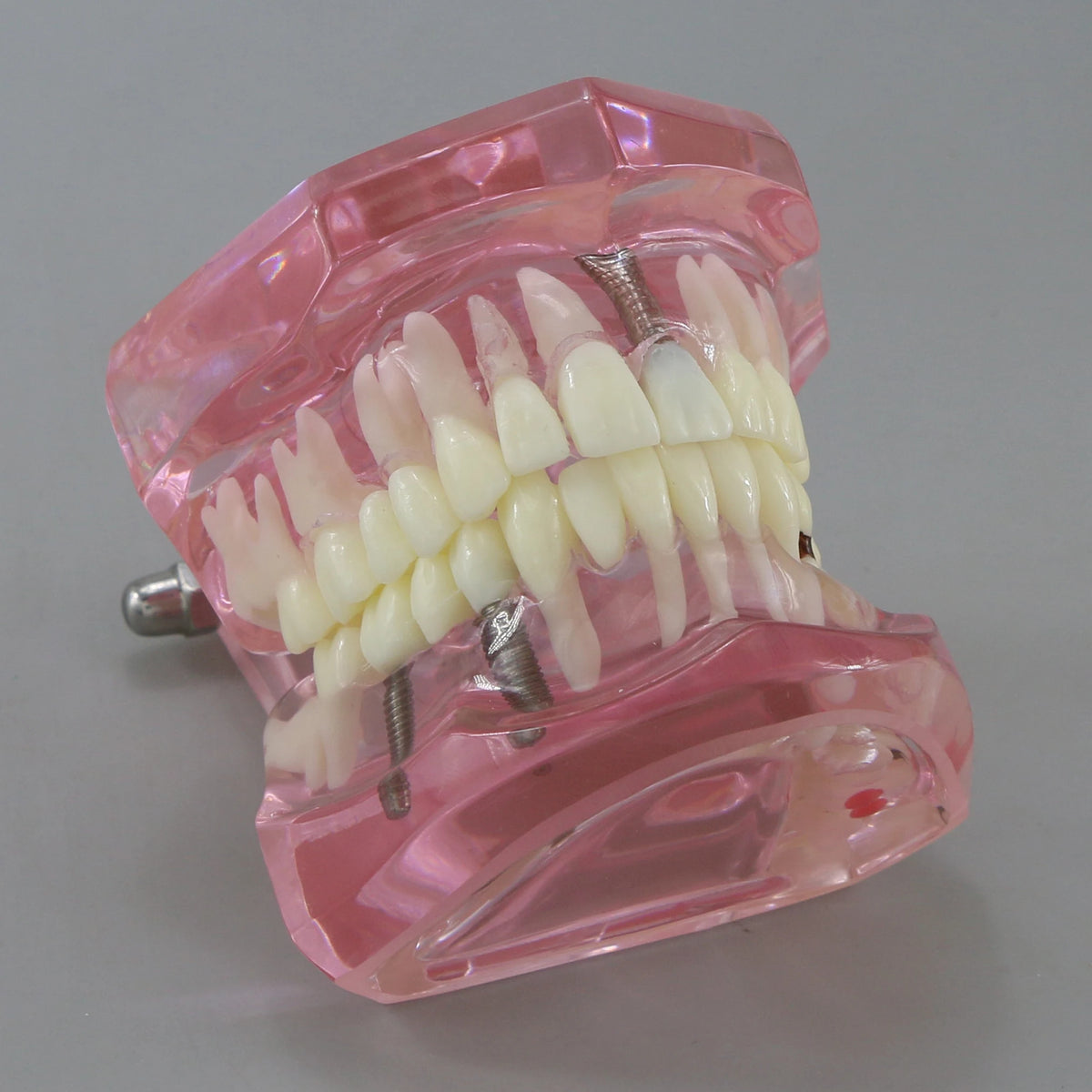 Dental Models Pink Disease Tooth Model Typodont Implant With Removable Tooth Restoration Bridge Teaching Tooth Model  M2001P