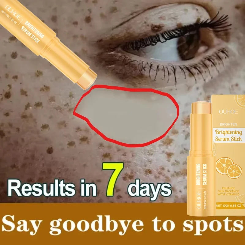 Vitamin C Whitening Freckles Serum Stick Remove Melasma Dark Spots Corrector Lighten Melanin Acne Anti-Aging Brighten Skin Care