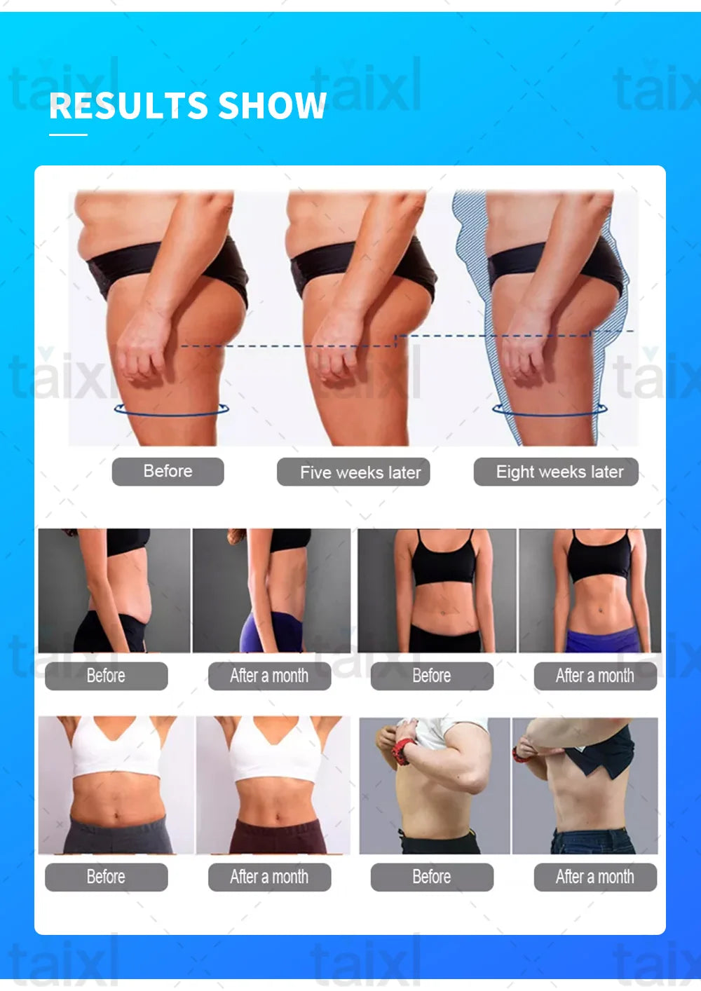 MYOslimEMS Body Sculpt Machine Roller Massage Fat Burner Body Care Massage Devices Muscle Stimulation Electromagnetic Device SPA